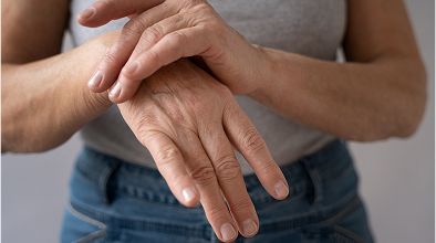 Arthritis or Joint Degeneration